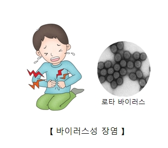 바이러스성 장염