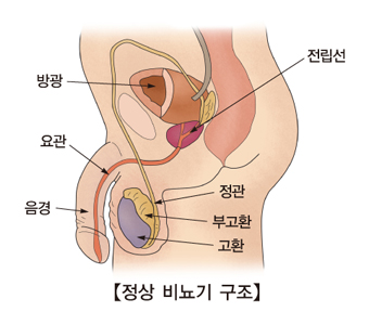 음낭내 부속기 염전