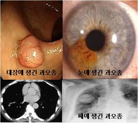 과오종