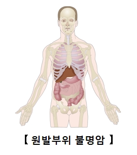 원발부위 불명암