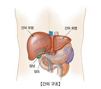 윌슨병