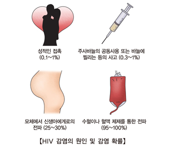 증상이 없는 HIV 감염