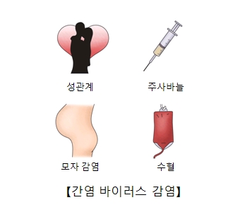 만성 C형 간염